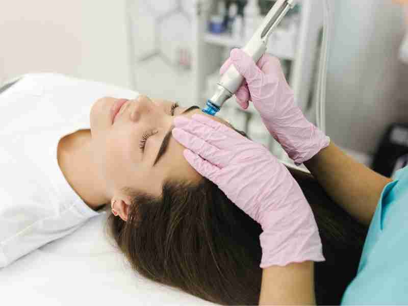 Dermaplaning - Imagen 2