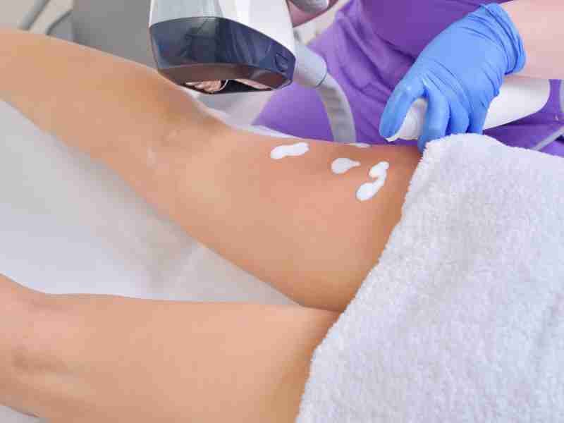 Velashape
